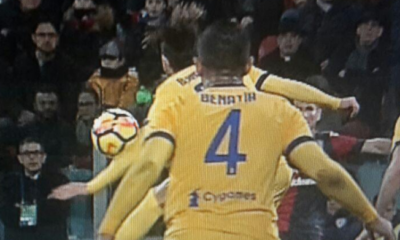 Bernardeschi braccio