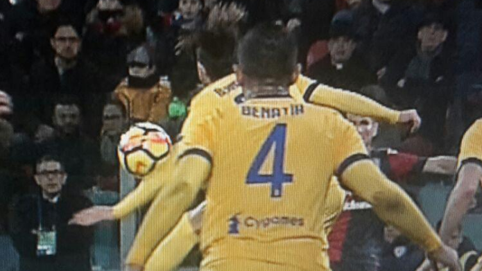 Bernardeschi braccio