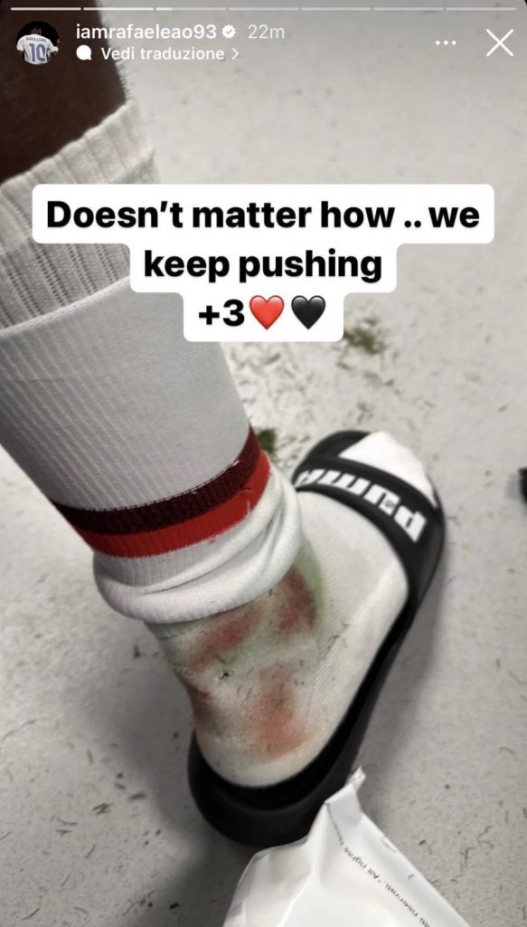 Roma Milan, Leao pubblica l'immagine della caviglia sui social - FOTO 27 leao 1